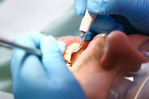 Best Walk-In Emergency Dentist in University Center, VA